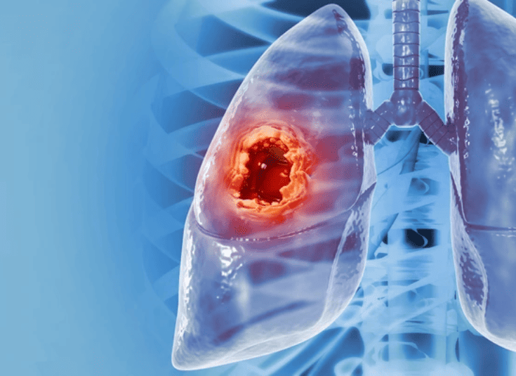 SLIDERIMAGE_1733949122287898_10105