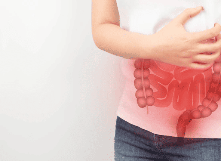 SLIDERIMAGE_1733949126192898_10105