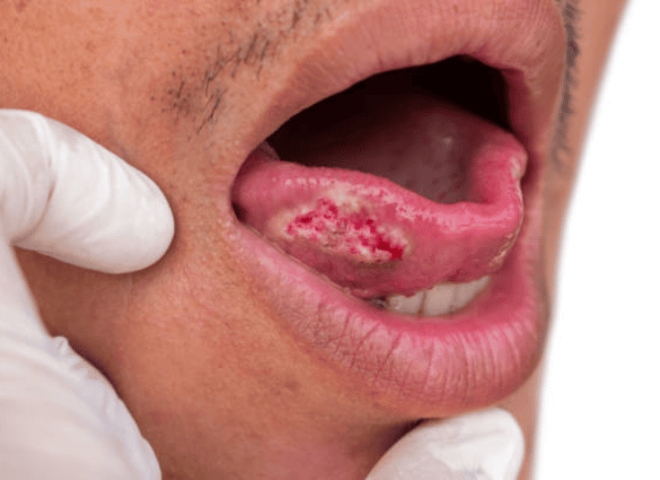 SLIDERIMAGE_1733949142354898_10105